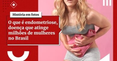 Dor na hora do sexo pode ser endometriose. Entenda