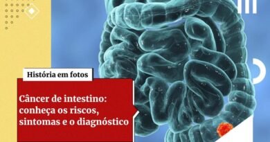 Estudos alertam para aumento de casos de câncer de intestino em jovens