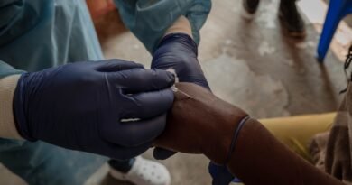 drcongo health virus mpox