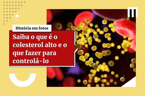 Cientistas descobrem quando colesterol bom pode se tornar prejudicial