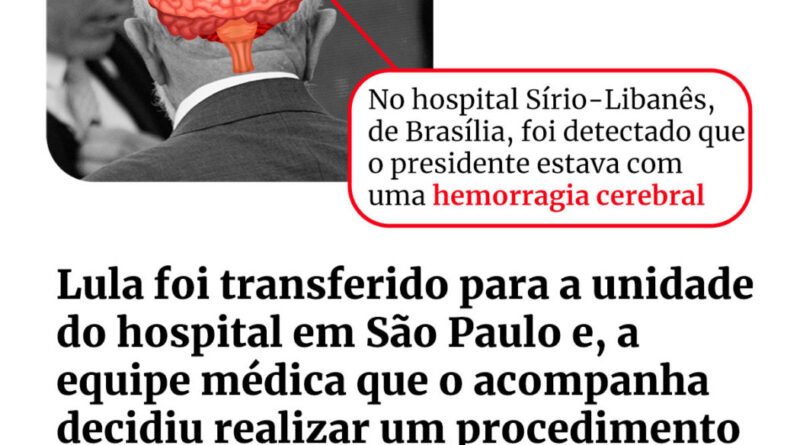 Infográfico sobre hemorragia intracraniana do presidente Lula - Metrópoles