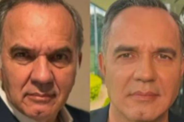 Humberto Martins faz harmonização facial e exibe novo visual: veja