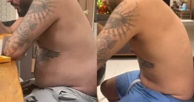 Kevinho vence depressão e faz foto de antes e depois: “Muita batalha”