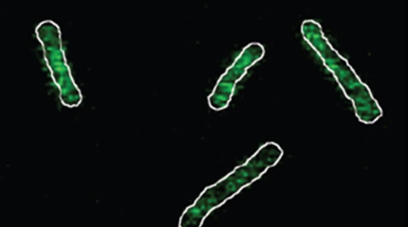 Bactéria resistente a antibióticos necessita de muito magnésio para sobreviver. Ilustração da pesquisa mostra em verde os átomos de magnésio e a pouca presença deles no ambiente quando a bactéria resistente se prolifera por ele