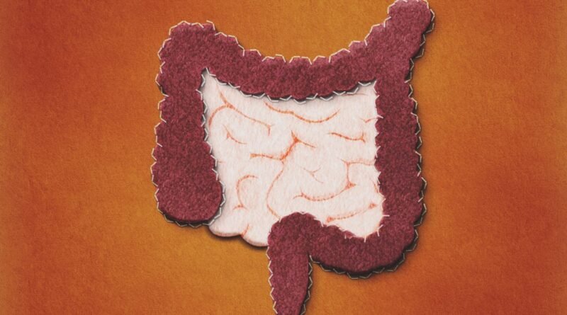 Imagem mostra uma representação de intestino feito de feltro - Metrópoles