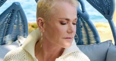 Xuxa revela que fez implante capilar e pensa em retomar “chuquinhas”